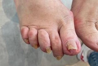 Medische voetverzorging
